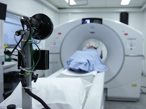 Alzheimer, l'accumulo precoce di tau predice il declino della memoria