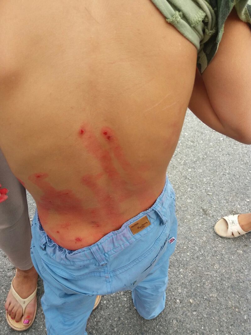 Bimbi rom con la scabbia nel campo nomadi di Castel Romano 5