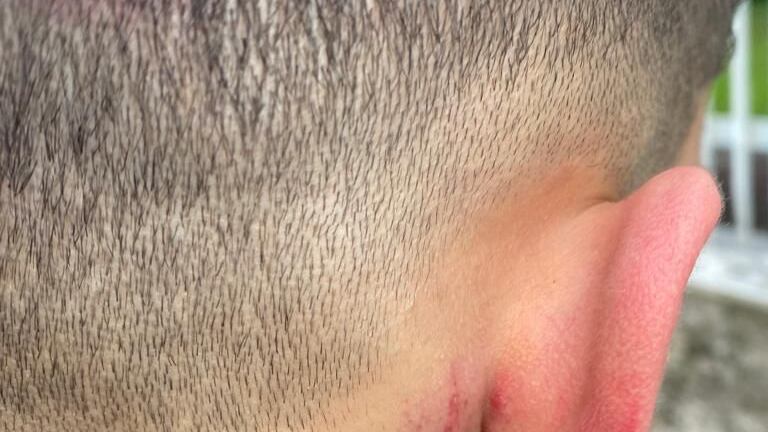 “Potevano ammazzarli”: ancora violenza nella notte a Milano. Due minorenni in ospedale