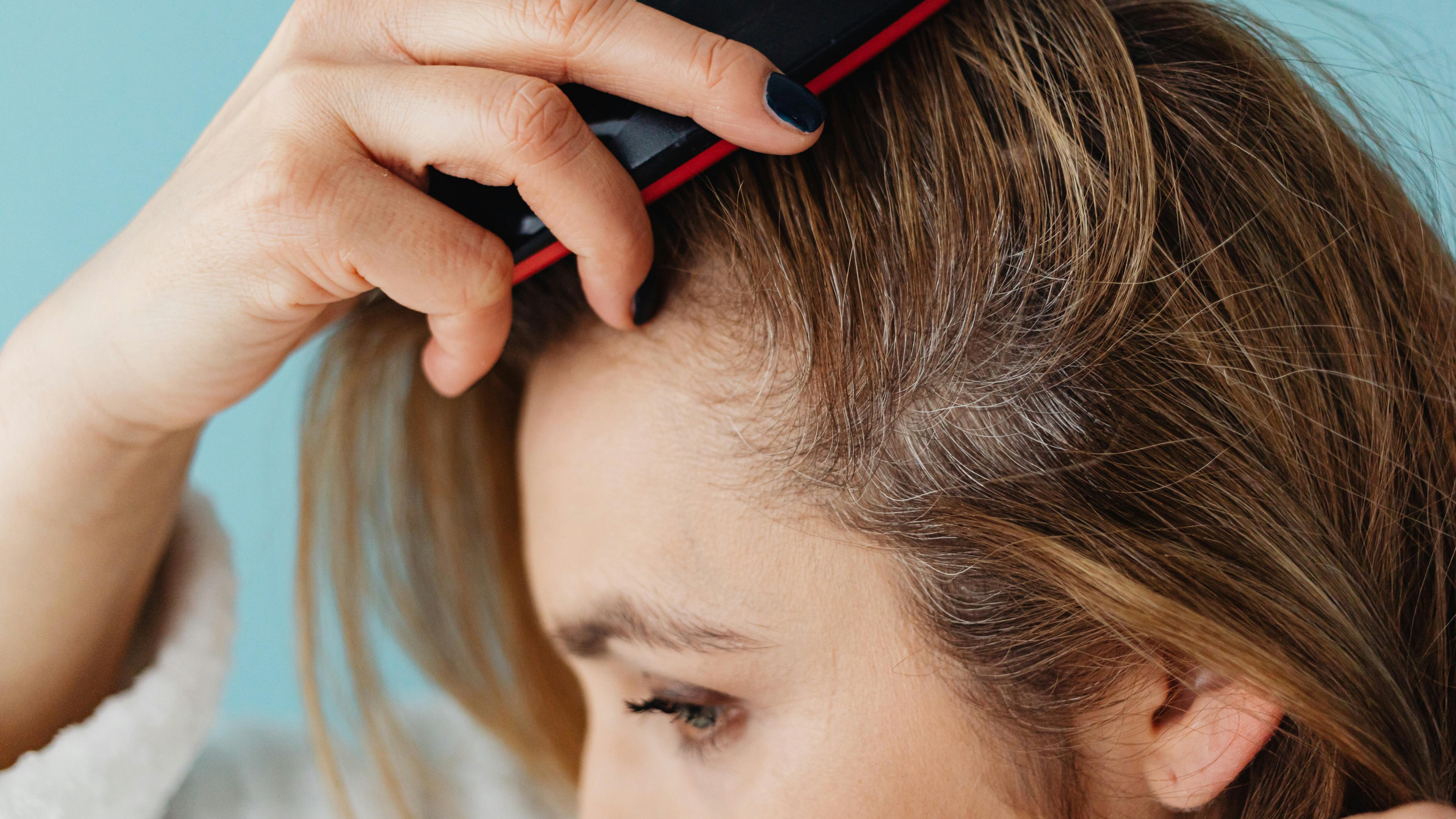 Capelli bianchi, una nuova ricerca suggerisce di assumere semi di sesamo per contrastarli: consumo e benefici