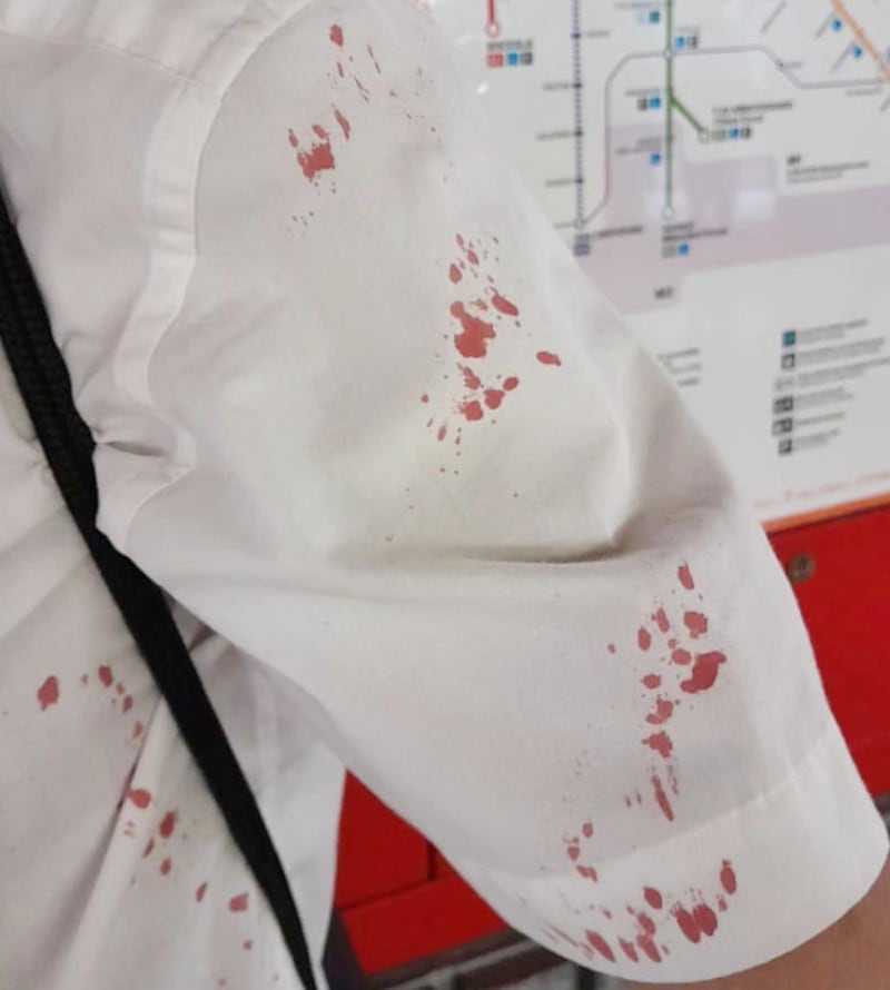 Ragazzo pestato a sangue in metropolitana dalle guardie del corpo di una borseggiatrice 3