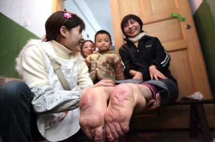 Wang Fang, la donna con i piedi al contrario  1