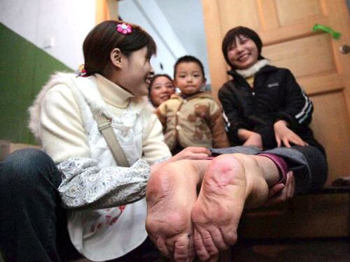 Wang Fang, la donna con i piedi al contrario