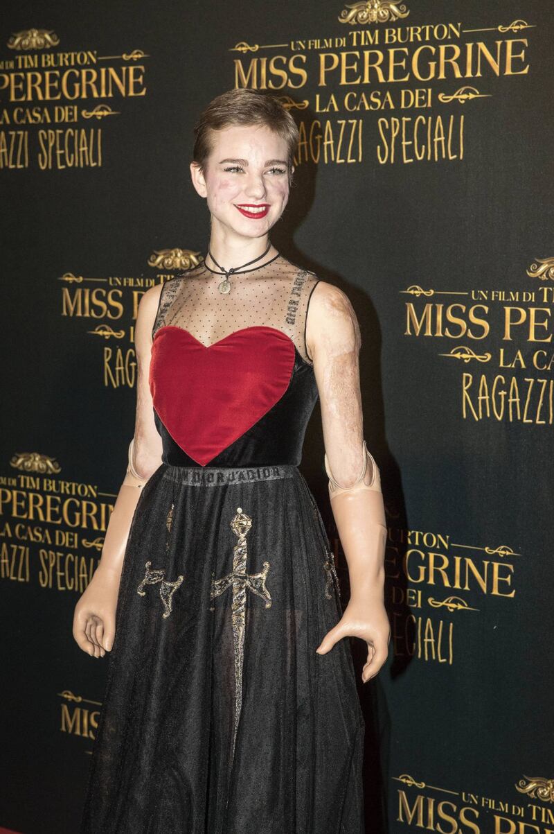 Bebe Vio, dalla medaglia d'oro al jet set 31