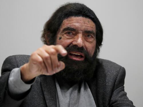 L'intellettuale ebreo aggredito per un libro: "Era un avvertimento"