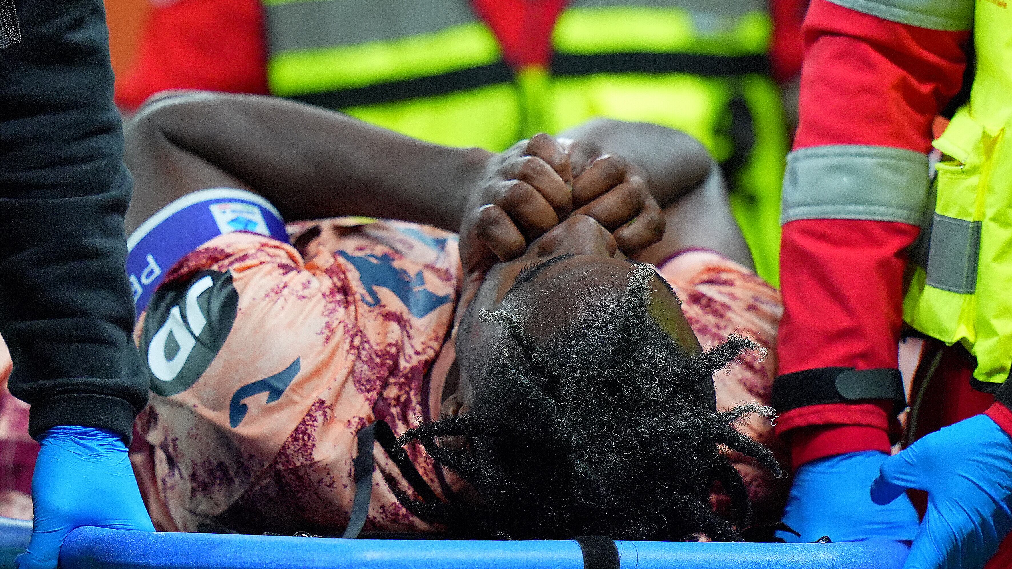 Duvan Zapata, l'infortunio è grave: stagione finita, c'è la rottura di legamento e menischi