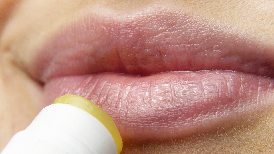 Il legame tra herpes simplex e stress emotivo