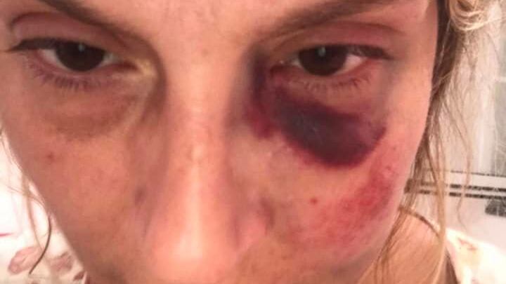 "Tutti guardavano, nessuno mi aiutava...". La brutale aggressione in spiaggia