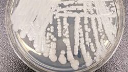 Il "fungo killer" che resiste agli antibiotici spaventa il Veneto: un morto