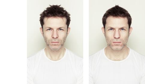 Il profilo migliore: le fotografie che raddoppiano solo una metà del volto 4
