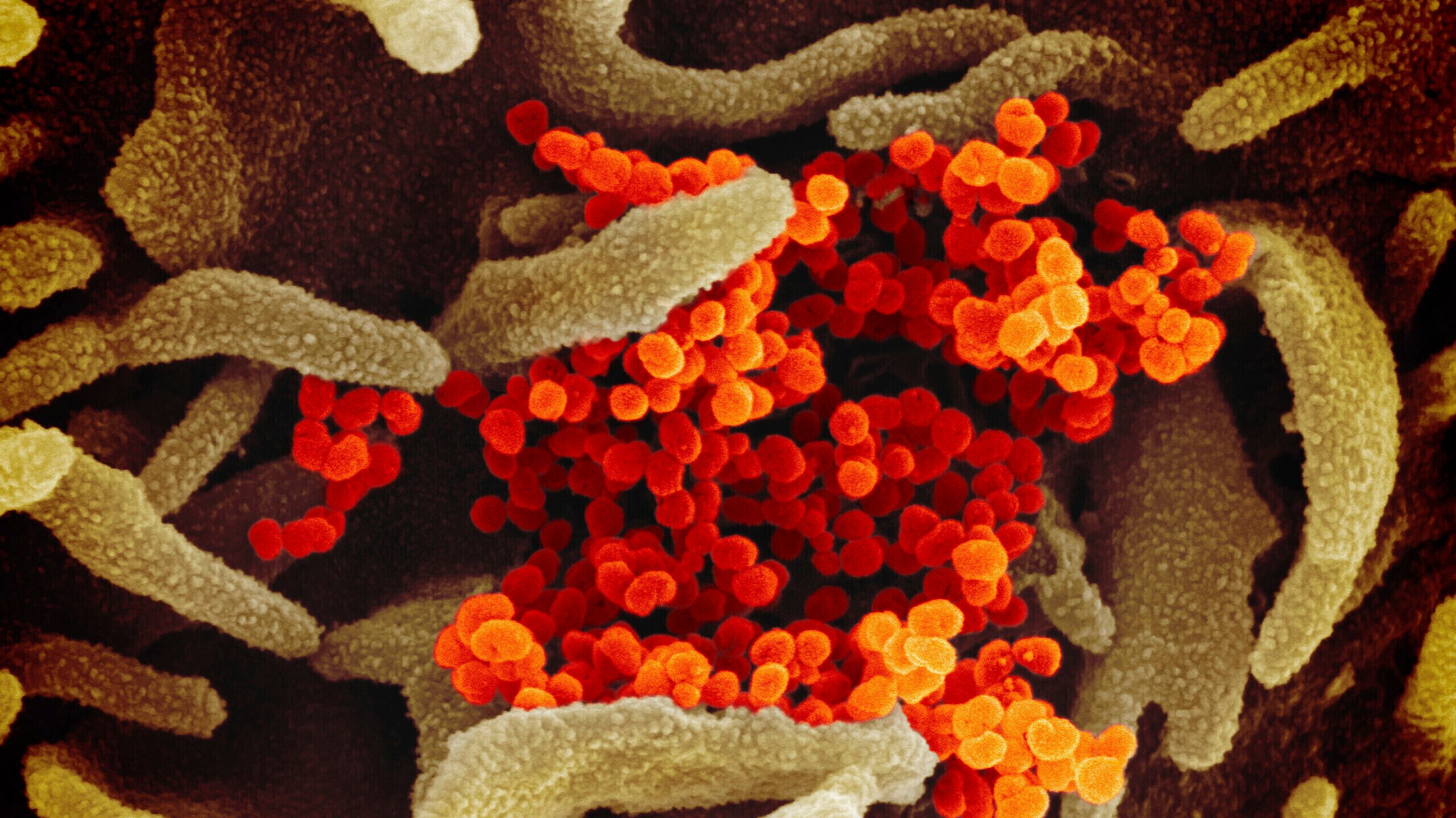 L'eterno incubo delle influenze. Perché sono i virus più temuti