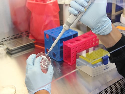 Leucemia mieloide acuta, la terapia immunitaria contro le recidive