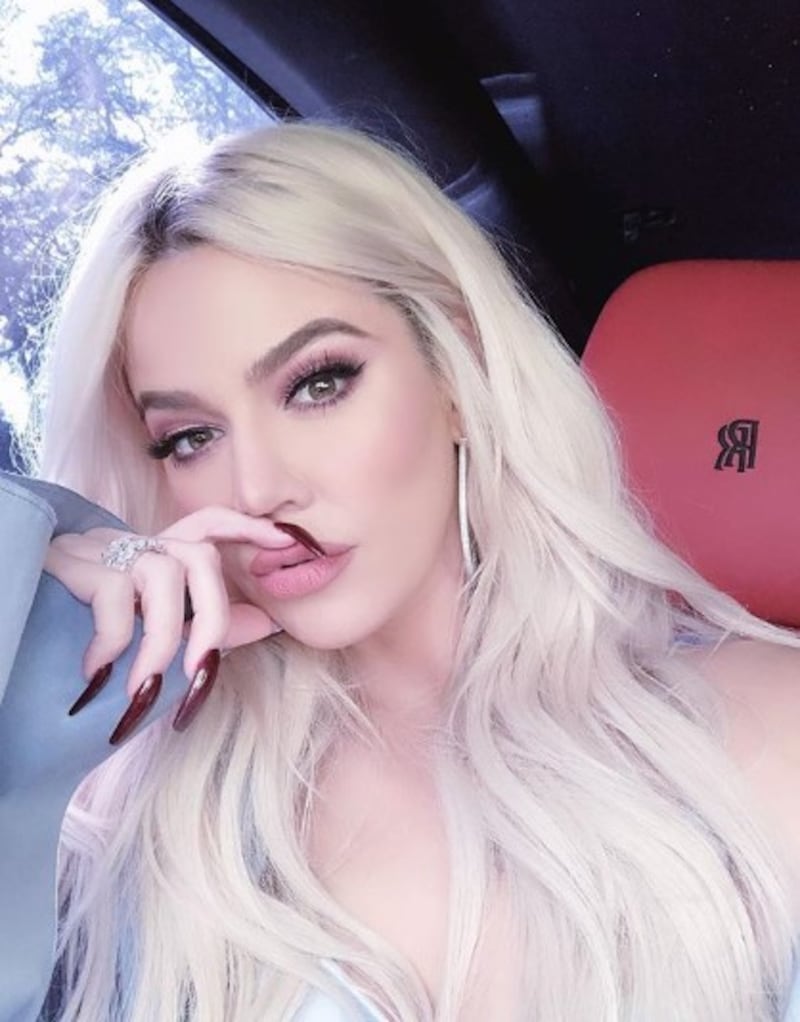 Khloe Kardashian sempre più irriconoscibile 3