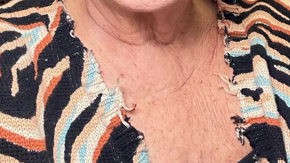 "Qualcuno annuncia la mia morte, ma è una bufala". La furia di Carolyn Smith