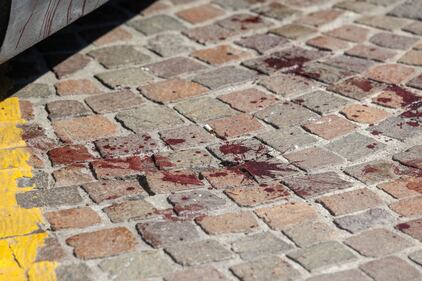 ragazzo accoltellato con il cane e soccorso da un passante. Gravissimo 6