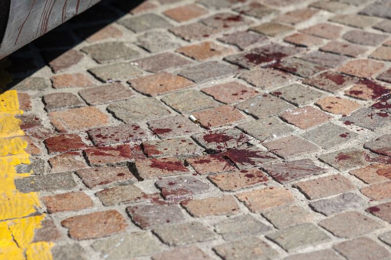 ragazzo accoltellato con il cane e soccorso da un passante. Gravissimo 6