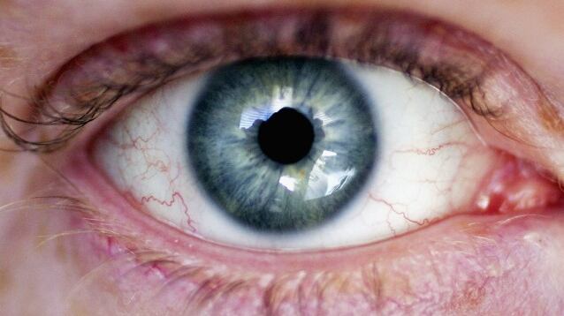 Usa, giovane fissa un puntatore laser per alcuni secondi: perde parte della retina
