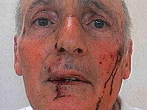 Albenga, rissa fra preti: "Sangue nel seminario"