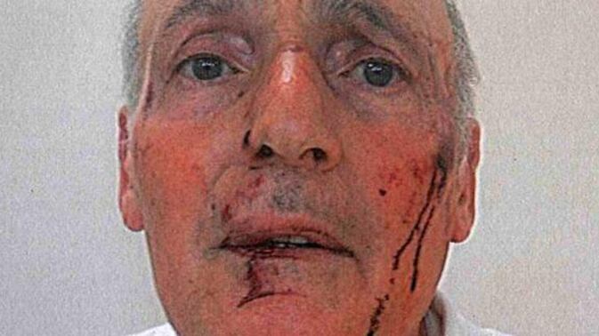 Albenga, rissa fra preti: "Sangue nel seminario"