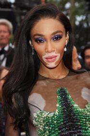 Winnie Harlow illumina il red carpet di Cannes 4
