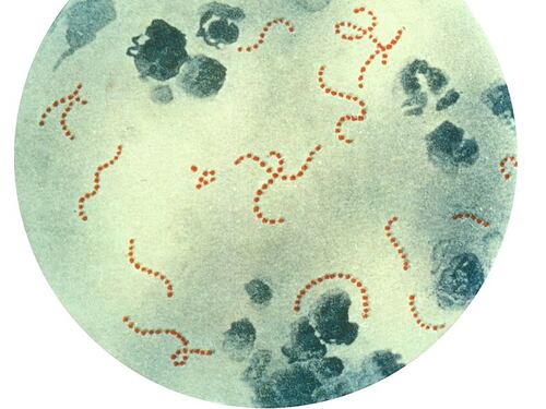 Streptococco killer, allarme in Giappone: trema anche l'Europa, come agisce l'infezione