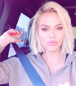 Khloe Kardashian sempre più irriconoscibile 4