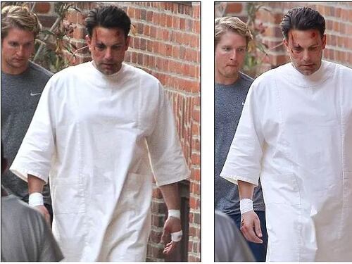 Ben Affleck pestato sul set