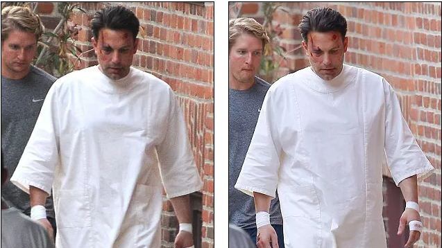 Ben Affleck pestato sul set