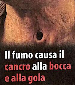 Le "immagini choc" sui pacchetti di sigarette 2