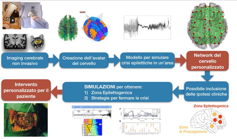 Paziente epilettico virtuale
