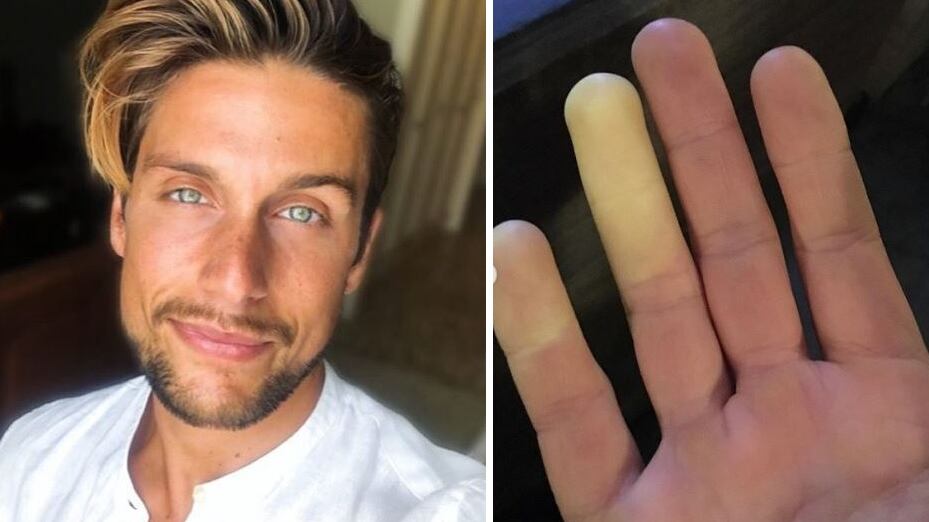 Il racconto choc di Andrea: "Soffrivo di una malattia rara"