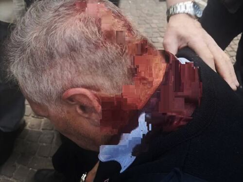 Il vigile rimprovera ragazzini in strada, loro gli spaccano la testa