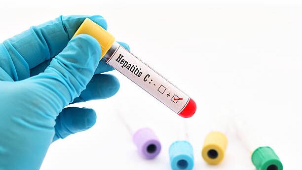Contagio, sintomi e diffusione: ecco perché l'epatite C fa paura