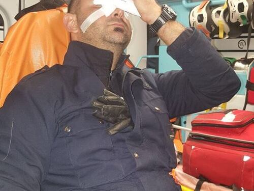 Milano, migrante con un ceppo di ferro massacra guardia sull'autobus