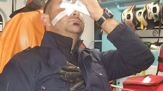 Milano, migrante con un ceppo di ferro massacra guardia sull'autobus