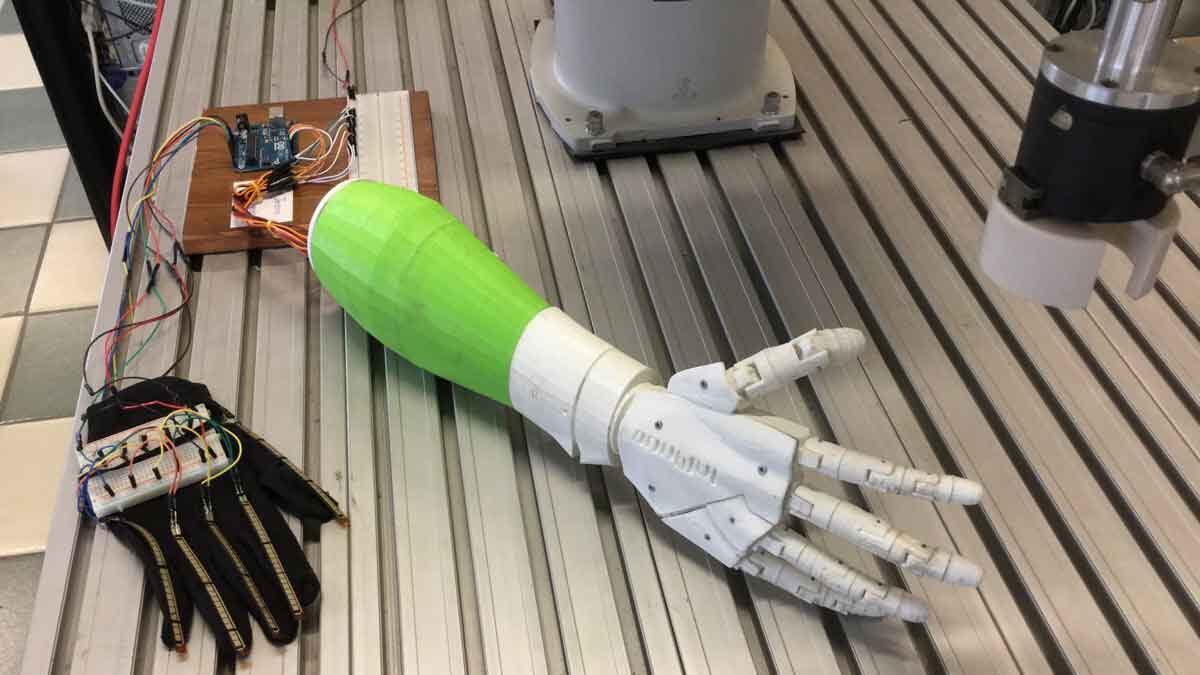 Francia, con stampa 3D arriva mano nuova per un bimbo di 6 anni