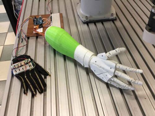 Francia, con stampa 3D arriva mano nuova per un bimbo di 6 anni