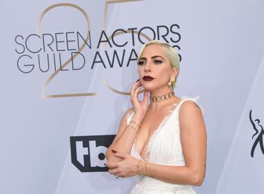 Lady Gaga, le foto della popstar 1