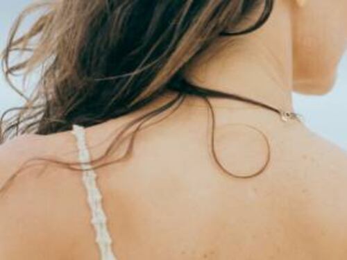Psoriasi, cos'è e come curarla