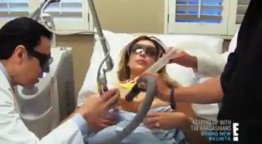 Kim Kardashian, laser sul seno per rimuovere le smagliature 8