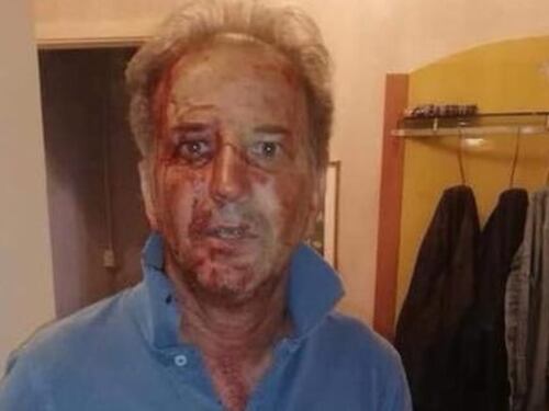 Migranti massacrano poliziotto. Il video incastra un clandestino