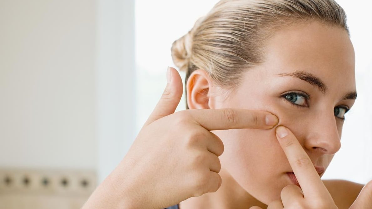 Acne: come combatterla in estate