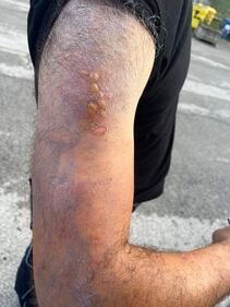 Agenti feriti dall'olio bollente in carcere a Cuneo 3