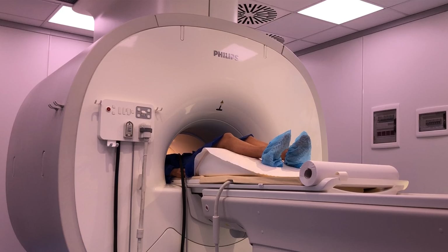 Ecco la Diffusion Whole Body, la risonanza magnetica che salva la vita
