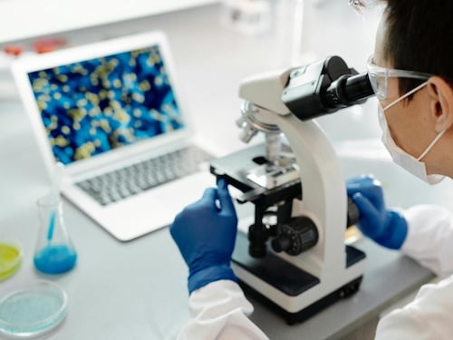 Tumore al pancreas, scoperto come si diffonde in fase precoce