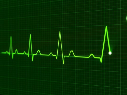 Il laser del Pentagono che identifica le persone dal battito del cuore