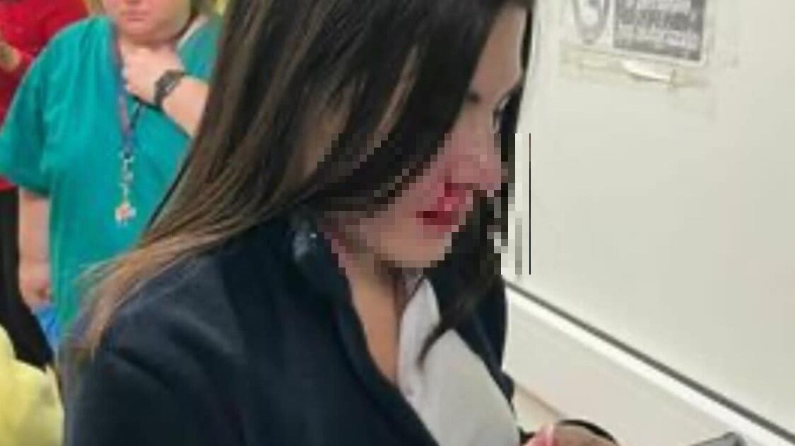 Infermiera pestata al pronto soccorso: naso e bocca spaccati, via due denti