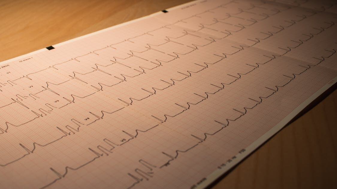 Insufficienza cardiaca over 60: cause, sintomi e cure