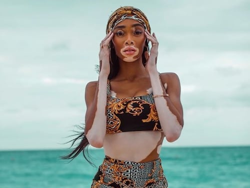 Winnie Harlow: "Grazie al successo porto la mia famiglia in vacanza"