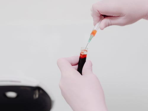Ferritina, 5 segnali che indicano che il valore è basso